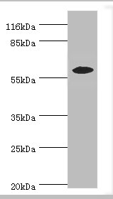 Western blot<br />All lanes: EPHX2 Polyclonal Antibody at 2ug/ml+MCF-7 whole cell lysate<br />Secondary<br />Goat polyclonal to rabbit at 1/10000 dilution<br />Predicted band size: 63, 58, 56 kDa<br />Observed band size: 57 kDa<br />