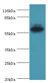 EPHX2 Polyclonal Antibody