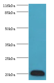 G0S2 Polyclonal Antibody