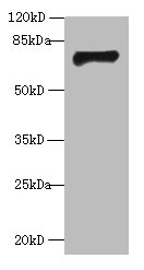 Western blot<br />All lanes: GABRA4 Polyclonal Antibody at 2ug/ml+mouse kidney tissue<br />Secondary<br />Goat polyclonal to rabbit at 1/10000 dilution<br />Predicted band size: 62kDa<br />Observed band size: 62kDa<br />