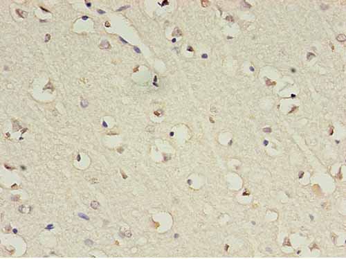 Immunohistochemistry of paraffin-embedded human brain at dilution 1:100