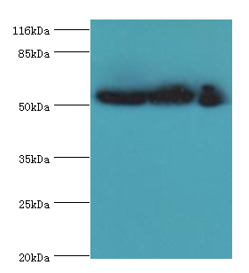 GDI2 Polyclonal Antibody