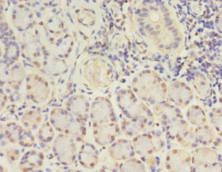GJB5 Polyclonal Antibody