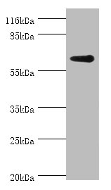 Western blot<br />All lanes: GK2 Polyclonal Antibody at 2ug/ml+jurkat whole cell lysate<br />Secondary<br />Goat polyclonal to rabbit at 1/10000 dilution<br />Predicted band size: 61kDa<br />Observed band size: 61kDa<br />