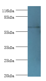 GK2 Polyclonal Antibody