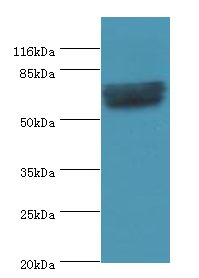 GRK4 Polyclonal Antibody