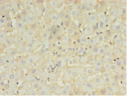 Immunohistochemistry of paraffin-embedded human liver at dilution 1:100