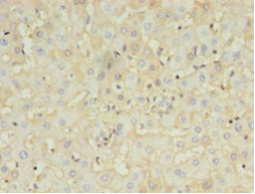 HBB Polyclonal Antibody
