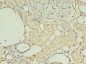 HNRNPL Polyclonal Antibody (20 µl)