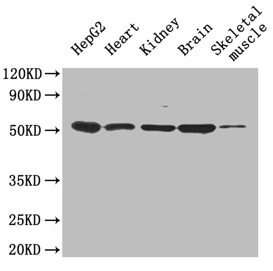 Igfbp1 Polyclonal Antibody