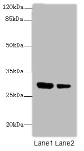 IL1A Polyclonal Antibody