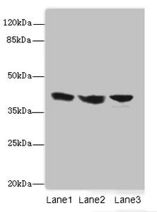 IL2RG Polyclonal Antibody
