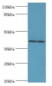 MAGEA10 Polyclonal Antibody