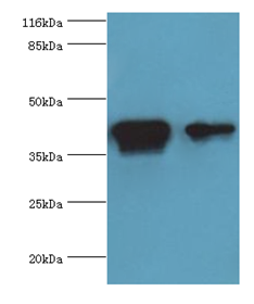 CKB Polyclonal Antibody