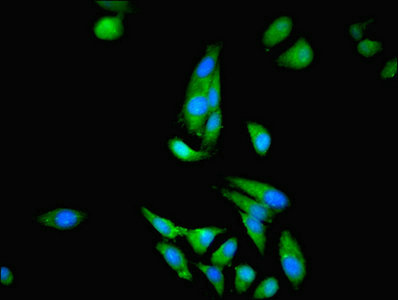 Immunofluorescent analysis of Hela cells using CKB Polyclonal Antibody at a dilution of 1:100 and Alexa Fluor 488-congugated AffiniPure Goat Anti-Rabbit IgG (H+L)