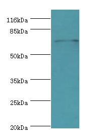 MTHFR Polyclonal Antibody