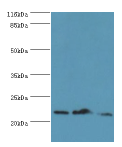 NDUFB5 Polyclonal Antibody