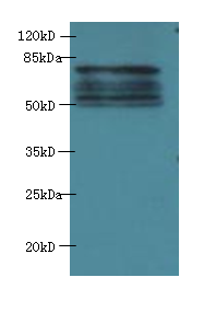 PAX3 Polyclonal Antibody