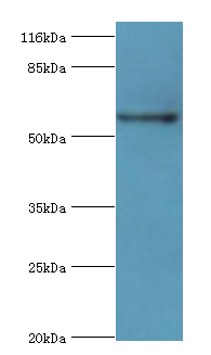 Pklr Polyclonal Antibody