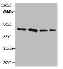 RAD23B Polyclonal Antibody (100 µl)