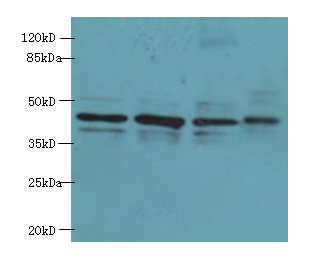 RAD23B Polyclonal Antibody