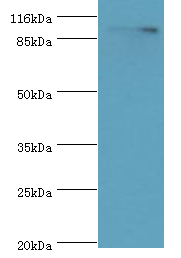 RRM1 Polyclonal Antibody