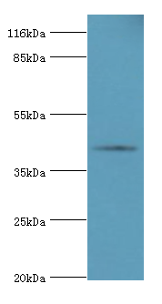SERPINB8 Polyclonal Antibody