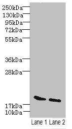 SKP1 Polyclonal Antibody