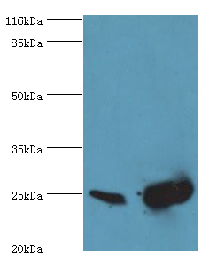 SOD2 Polyclonal Antibody