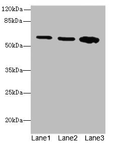 SPTLC2 Polyclonal Antibody