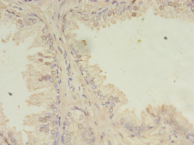 SSFA2 Polyclonal Antibody