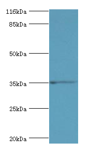 SULT1B1 Polyclonal Antibody