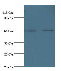 THRA Polyclonal Antibody