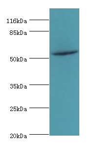 THRB Polyclonal Antibody