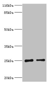 TK1 Polyclonal Antibody (50 µl)