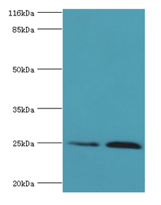 TK1 Polyclonal Antibody