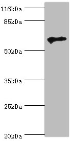 TPTE Polyclonal Antibody (100 µl)
