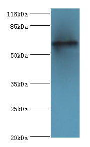 TPTE Polyclonal Antibody