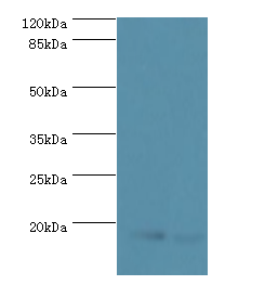 UBE2D1 Polyclonal Antibody