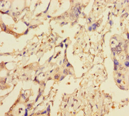 XIAP Polyclonal Antibody