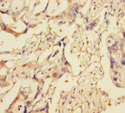 XIAP Polyclonal Antibody