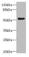 ZNF212 Polyclonal Antibody