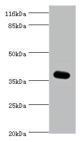 Western blot<br />All lanes: EIF3G Polyclonal Antibody at 2ug/ml+HepG2 whole cell lysate<br />Secondary<br />Goat polyclonal to rabbit at 1/10000 dilution<br />Predicted band size: 36kDa<br />Observed band size: 36kDa<br />