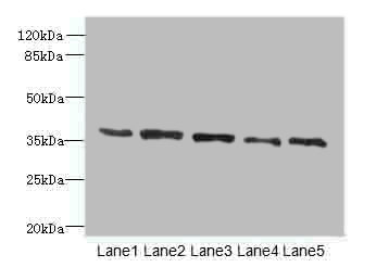 PLAUR Polyclonal Antibody