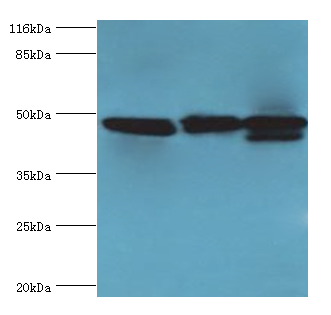 CALR Polyclonal Antibody