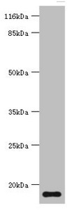 Western blot<br />All lanes: NPPB Polyclonal Antibody at 2ug/ml+mouse brain tissue<br />Secondary<br />Goat polyclonal to rabbit at 1/10000 dilution<br />Predicted band size: 15kDa<br />Observed band size: 15kDa<br />