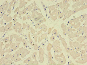 Immunohistochemistry of paraffin-embedded human heart tissue using NPPB Polyclonal Antibody at dilution 1:100