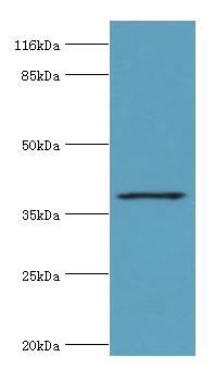 HAVCR1 Polyclonal Antibody