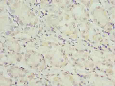 AGT Polyclonal Antibody