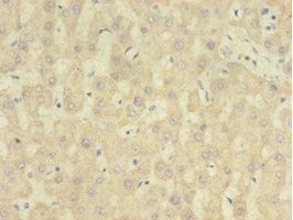 Immunohistochemistry of paraffin-embedded human liver tissue using RARRES2 Polyclonal Antibody at dilution 1:100